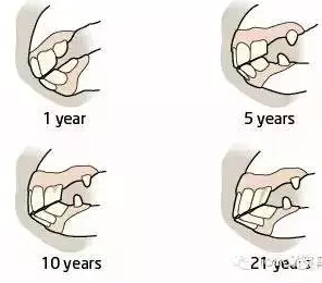 一张图简单的分析马儿牙齿年龄变化!